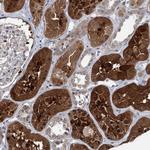 AKNAD1 Polyclonal Antibody