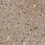 NCOA7 Polyclonal Antibody