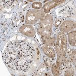 NCOA7 Antibody in Immunohistochemistry (Paraffin) (IHC (P))