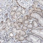 NCOA7 Polyclonal Antibody