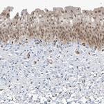 NCOA7 Antibody in Immunohistochemistry (IHC)