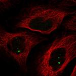 NCOA7 Polyclonal Antibody