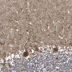 NCOA7 Antibody in Immunohistochemistry (Paraffin) (IHC (P))