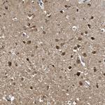 NCOA7 Antibody in Immunohistochemistry (Paraffin) (IHC (P))