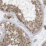NCOA7 Antibody in Immunohistochemistry (Paraffin) (IHC (P))