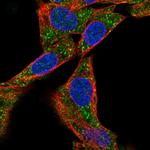 METAP1D Polyclonal Antibody