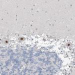 METAP1D Antibody in Immunohistochemistry (Paraffin) (IHC (P))