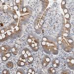 TYSND1 Antibody in Immunohistochemistry (Paraffin) (IHC (P))