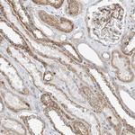 TYSND1 Polyclonal Antibody