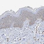 TYSND1 Antibody in Immunohistochemistry (Paraffin) (IHC (P))