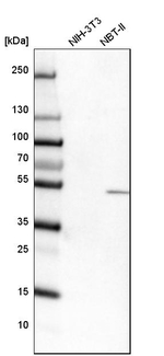 TYSND1 Antibody in Western Blot (WB)