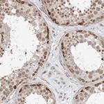 TYSND1 Antibody in Immunohistochemistry (IHC)