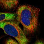 PUM2 Polyclonal Antibody