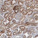 PUM2 Antibody in Immunohistochemistry (Paraffin) (IHC (P))