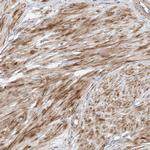 PUM2 Antibody in Immunohistochemistry (Paraffin) (IHC (P))