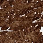 PUM2 Antibody in Immunohistochemistry (Paraffin) (IHC (P))