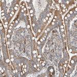 PUM2 Antibody in Immunohistochemistry (Paraffin) (IHC (P))