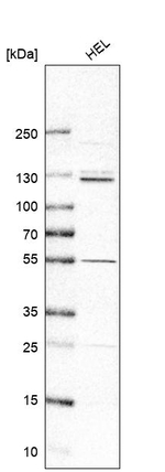 PUM2 Antibody in Western Blot (WB)