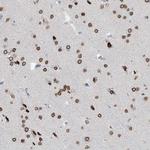 PRDM6 Antibody in Immunohistochemistry (Paraffin) (IHC (P))