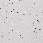 PRDM6 Antibody in Immunohistochemistry (Paraffin) (IHC (P))