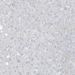PRDM6 Antibody in Immunohistochemistry (Paraffin) (IHC (P))