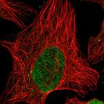 PM20D2 Polyclonal Antibody