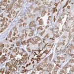 Pirh2 Antibody in Immunohistochemistry (Paraffin) (IHC (P))