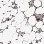 RhoH Polyclonal Antibody