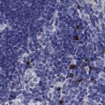 FRMD1 Antibody in Immunohistochemistry (IHC)