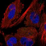 MTMR11 Polyclonal Antibody