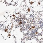 MTMR11 Antibody in Immunohistochemistry (Paraffin) (IHC (P))