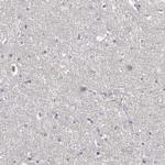 NT5D1 Polyclonal Antibody