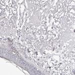 NT5D1 Antibody in Immunohistochemistry (Paraffin) (IHC (P))