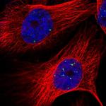 LYRM4 Polyclonal Antibody