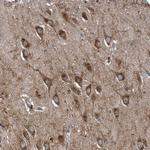 LYRM4 Antibody in Immunohistochemistry (Paraffin) (IHC (P))