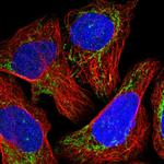 NDUFB11 Polyclonal Antibody