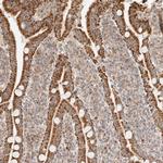 NDUFB11 Antibody in Immunohistochemistry (Paraffin) (IHC (P))