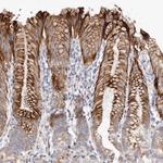 ZYG11A Polyclonal Antibody