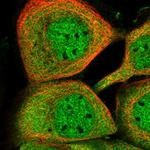 KCMF1 Polyclonal Antibody