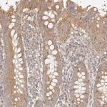 KCMF1 Antibody in Immunohistochemistry (IHC)