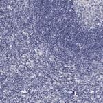 GDA Antibody in Immunohistochemistry (IHC)