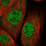 ZNF30 Polyclonal Antibody