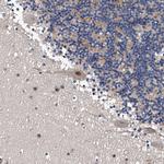 ZNF30 Antibody in Immunohistochemistry (Paraffin) (IHC (P))