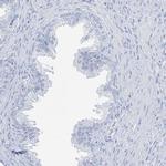 TXLNB Polyclonal Antibody