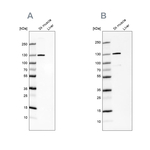 TXLNB Antibody in Western Blot (WB)