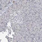 TXLNB Antibody in Immunohistochemistry (IHC)