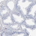 TXLNB Polyclonal Antibody