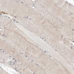 ARHGAP28 Antibody in Immunohistochemistry (Paraffin) (IHC (P))