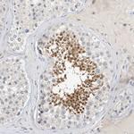 ARHGAP28 Antibody in Immunohistochemistry (Paraffin) (IHC (P))
