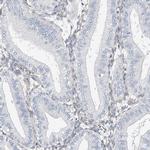 ARHGAP28 Antibody in Immunohistochemistry (IHC)